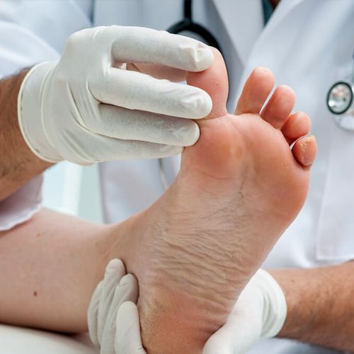 Mobile Foot Care Edmonton