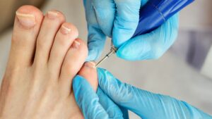 Professional Foot Care Edmonton 2 Professional Foot Care Edmonton