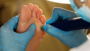 Mobile Pedicure For Senior